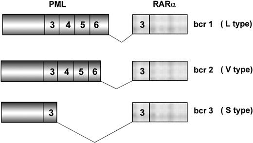 Fig. 2. Schematic representation of the three major PML/RAR fusion transcripts. Breakpoints on the RAR gene always occur within intron 2. Due to distinct breakpoints on the PML gene (intron 6, exon 6, and intron 3), different segments of this latter are fused to RAR exon 3, resulting in bcr1 (L type), bcr2 (V type), and bcr3 (S type) fusion transcripts, respectively. Numbers in boxes represent PML and RAR exons.
