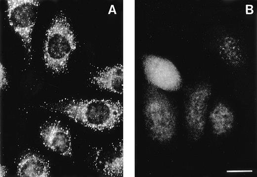 Fig. 3. The AP-3 delta subunit has a weak, diffuse localization pattern in pearl cells. Immunofluorescence was conducted on melan-a cells, a normal melanocyte cell line (A), on pearl melanocyte-derived cells (B), on macrophages of normal (C) and pearl (D) mice, and on platelets of normal (E) and pearl (F) mice. Scale bar = 10 μm.