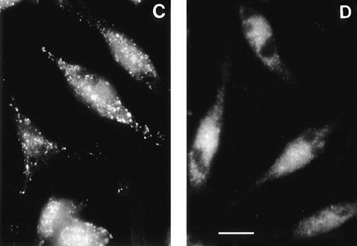 Fig. 3. The AP-3 delta subunit has a weak, diffuse localization pattern in pearl cells. Immunofluorescence was conducted on melan-a cells, a normal melanocyte cell line (A), on pearl melanocyte-derived cells (B), on macrophages of normal (C) and pearl (D) mice, and on platelets of normal (E) and pearl (F) mice. Scale bar = 10 μm.