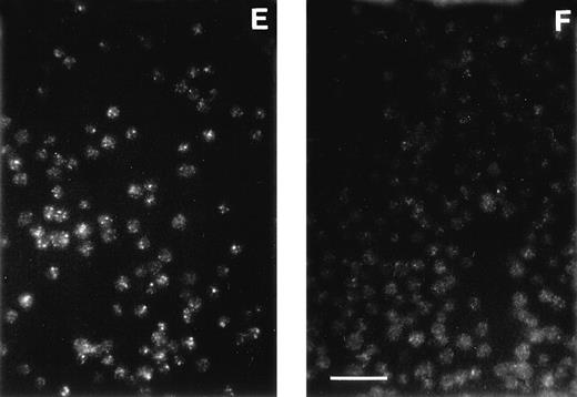 Fig. 3. The AP-3 delta subunit has a weak, diffuse localization pattern in pearl cells. Immunofluorescence was conducted on melan-a cells, a normal melanocyte cell line (A), on pearl melanocyte-derived cells (B), on macrophages of normal (C) and pearl (D) mice, and on platelets of normal (E) and pearl (F) mice. Scale bar = 10 μm.