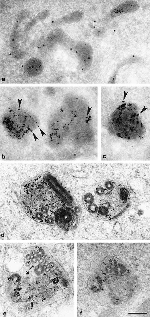 Fig. 4. Endocytosed BSA-gold accumulates in lgp110-positive electron-dense lysosomes. (a through c) Pearl cells were allowed to endocytose BSA-10 nm gold for 4 hours followed by a chase in conjugate-free medium for 20 hours. Gold accumulated in electron dense lysosomes which could be immunolabeled with antibodies to the lysosomal marker lgp110 (15 nm gold). Although most of the lysosomes were of normal appearance (a), some were filled with rolled-up membranous inclusions (b and c; arrowheads indicate the 15 nm gold-labeled lgp110). (d through f) Plastic sections of BSA-10 nm gold-containing lysosomes, showing the internal membranes. Scale bar = 200 nm.