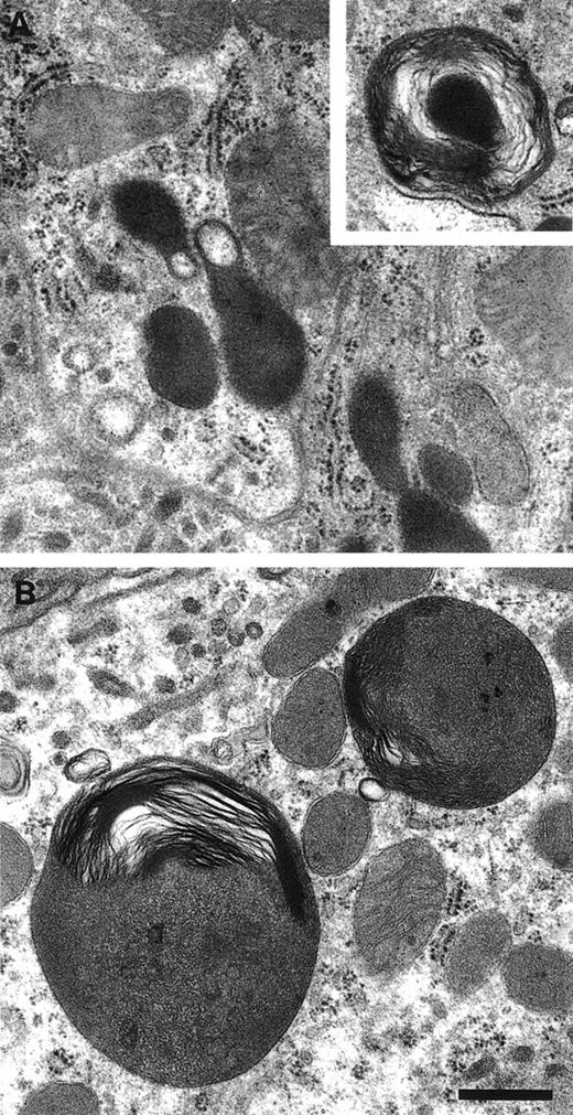 Fig. 5. Abnormal lysosomal morphology in kidney proximal tubules of the pearl mutant. Kidneys from normal (A) and pearl (B) mice were examined by standard TEM. Inset shows a rare small multilamellar lysosome in normal tissue. Scale bar = 500 nm.