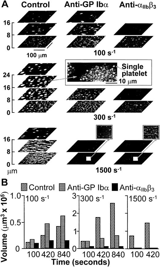 Fig. 1. (A) Structure of thrombi formed at different shear rates in the absence (Control) or presence of monoclonal antibodies blocking GP Ib (LJ-Ib1, 100 μg/ml) or IIbβ3(LJ-CP8, 100 μg/ml), visualized by confocal optical sections at 1-μm intervals in the z-axis. Each plane shows an area of 52,345 μm2. For clarity, the z scale is expanded and only sections at selected distances from the surface are presented. Confocal sections were obtained after 840 seconds of flow at either 100 or 300 s−1, or after 420 seconds at 1,500 s−1. The inset in the middle panel displays the partial reproduction with less size reduction of a thrombus formed at wall shear rate of 300 s−1, demonstrating the resolution of single platelets in the confocal sections. The two insets in the bottom panel show with greater magnification part of the surfaces exposed to antibody-containing blood flowing with wall shear rate of 1,500 s−1. No thrombi were formed, but single platelets could easily be detected. Note that the confocal sections shown here are intended to give a global view of thrombus formation and not to visualize single platelets. (B) Total volume of thrombi calculated from confocal sections. Representative experiment of two that gave comparable results. Experiments at the shear rate of 1,500 s−1 were terminated after collecting z sections at 420 seconds when thrombi had already reached a large volume. Prolonging perfusion at this shear rate resulted in markedly abnormal flow patterns owing to nearly complete occlusion of the chamber.