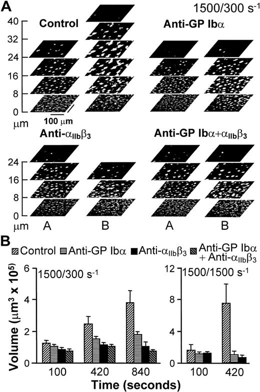 Fig. 2. Progression of thrombus growth in 2-stage experiments, first with perfusion of untreated blood over collagen type I fibrils at 1,500 s−1 for 100 seconds, then continuing without interruption at 300 or 1,500 s−1 with blood containing either buffer (Control) or specific monoclonal antibodies, as indicated. Antibodies were incubated in blood for 10 minutes before initiating perfusion. (A) Stacks of z sections labeledA show thrombi formed after 100 seconds of perfusion with blood containing no antibody at wall shear rate of 1,500 s−1; those labeled B show the growth of thrombi after an additional 740 seconds of perfusion at 300 s−1with blood containing either buffer or the indicated antibodies (total perfusion time, 840 seconds). The effect of the antibodies in limiting increase in thrombus height, as clearly seen, is representative of the results observed in all experiments. (B) Thrombus volume was measured at the indicated cumulative perfusion times in these two-stage experiments. Bars are identified according to the type of inhibitor used in the second stage, but perfusion for the first 100 seconds was always performed with untreated blood. The results are expressed as mean ± SEM of between 4 and 10 experiments for the different conditions tested. Note that experiments at the shear rate of 1,500 s−1 were terminated after collecting z sections at 420 seconds, since thrombi had already reached a large volume in control blood. Experiments with the combination of anti-GP Ib and anti-IIbβ3 monoclonal antibodies were not performed at 1,500 s−1 since at this shear rate each individual antibody completely prevented thrombus growth as compared to the volume attained after the initial perfusion for 100 seconds with untreated blood.