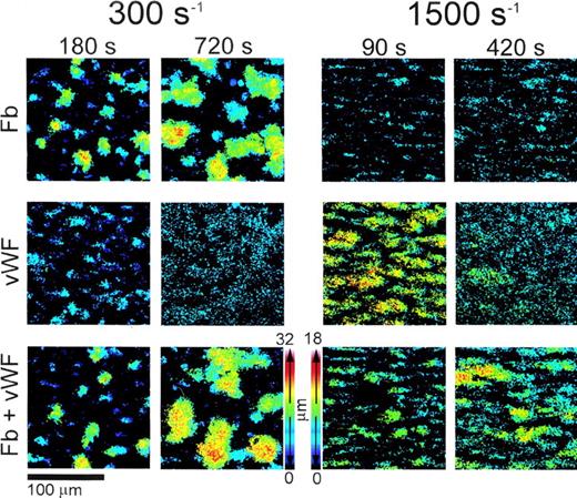 Fig. 4. Color rendition of the shape and height of thrombi formed on type I collagen fibrils at different wall shear rates. Washed blood cells and adhesive proteins were used as described in the legend to Fig3. Note that both at 300 s−1 and 1,500 s−1, larger thrombi were present at later perfusion times in the presence of vWF and fibrinogen (Fb) combined than either of the two ligands alone. To obtain these pseudocolor images, stacks of confocal sections taken throughout the height of thrombi at 1-μm intervals in thez-axis were processed after fixing brightness and contrast. Noise was reduced by applying a 3 × 3 median filter, and images were binarized so that the gray scale value of all the pixels above a set threshold was 255. The value of each pixel composing individual images in a shear rate group was then multiplied by a factor, p/N, where p is the plane number (distance from the surface in μm) corresponding to the image, and N is the number of images in the stack including the thrombus of maximum height in that group. After this operation, the value of each pixel in a stack of confocal sections was proportional to the position in the z axis, ie, to height, and could be used to generate single pseudocolor images using for each pixel the maximum calculated intensity value in the stack. Thrombi were larger in the experiments performed at 300 s−1 than at 1,500 s−1 owing to longer perfusion times; thus, distinct height calibration color scales were calculated for the two groups, as shown.
