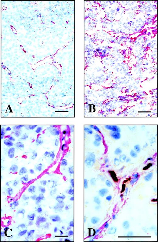 Fig. 1. Immunohistochemical analysis of the distribution of B-FN in human and mouse grafted tumor models. Immunostaining of cryostat sections of F9 mouse teratocarcinoma allograft (A), N592 human small cell lung carcinoma xenograft (B), and SKMEL-28 human melanoma (C) using the antibody fragment L19. (D) A double staining of the SKMEL-28 human melanoma xenograft using the antibody fragment L19 (red staining) and an MoAb to mouse CD31, a marker of endothelial cells (brown staining). Scale bars: A, B, and D: 10 μm; C: 4 μm.