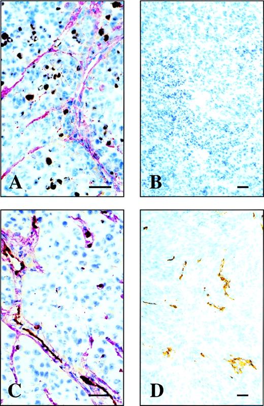 Fig. 2. B-FN accumulates around the vessels of exponentially growing tumors but not on vessels of quiescent tumors. Cryostat sections of the SKMEL-28 xenograft in the exponentially growing phase (A and C) and in the quiescent phase (B and D). Sections shown in (A) and (B) were double stained using the antibody fragment L19 to B-FN (red staining) and the MoAb KI67 specific for proliferating cells (brown staining). Sections shown in (C) and (D) were double stained using the antibody fragment L19 to BFN (red staining) and a rat MoAb recognizing murine CD31, a marker of endothelial cells (brown staining). The bar corresponds to 10 μm.