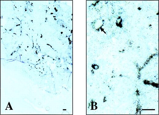 Fig. 6. Microautoradiography of an F9 teratocarcinoma dissected from a nude mouse, after injection of radiolabeled L19. Two different magnifications of a microautoradiography of a F9 mouse teratocarcinoma. The radiolabeled L19 accumulates around vascular structures within the F9 mouse tumor but not in the surrounding normal mouse tissue (A). At higher magnification (B) within the lumens of some vessels, the red blood cells are visible (arrow). The bar corresponds to 10 μm.