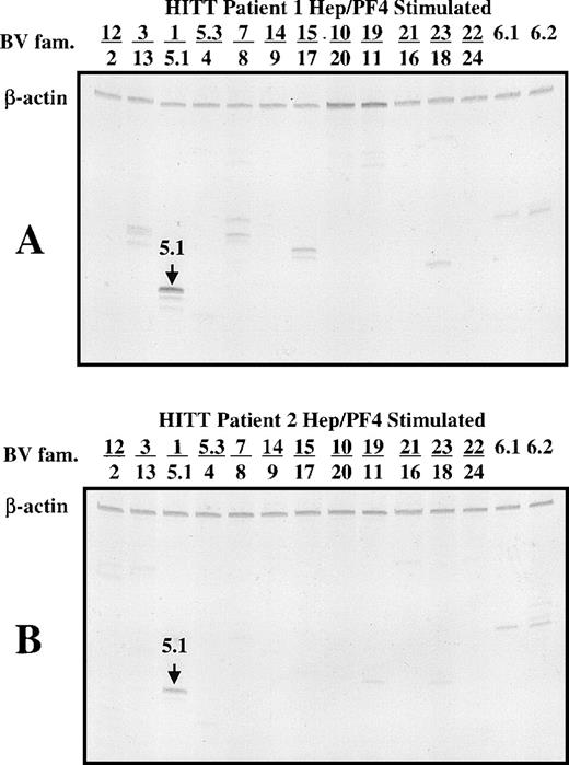 Fig. 2. Polyacrylamide gel shows TCR spectratype analysis of T cells from patient 1 (A), patient 2 (B), and a normal subject (C) after 14 days of culture in the presence of heparin:PF4. The spectratypes shown were generated using template cDNA diluted 1:100 (patient 1) and 1:10 (patient 2 and normal subject) to illustrate the dominant PCR products.