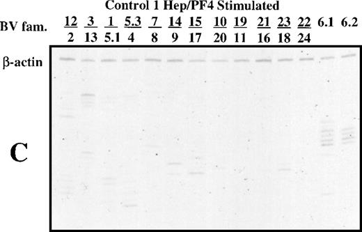 Fig. 2. Polyacrylamide gel shows TCR spectratype analysis of T cells from patient 1 (A), patient 2 (B), and a normal subject (C) after 14 days of culture in the presence of heparin:PF4. The spectratypes shown were generated using template cDNA diluted 1:100 (patient 1) and 1:10 (patient 2 and normal subject) to illustrate the dominant PCR products.