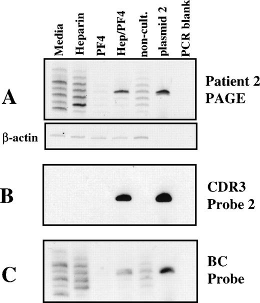 Fig. 6. Analysis of clonotype specificity of cultured PBMC from patient 2. The lanes are labeled as described in Fig 5, except that only 1 plasmid control is included. (A) Spectratype gel. The actin control amplification is shown as a separate subpanel. (B) Hybridization of the DNA from the gel shown in A with a probe for clonotype 2. (C) Rehybridization of the membrane with a TCR β constant region probe after stripping of the previous probe.
