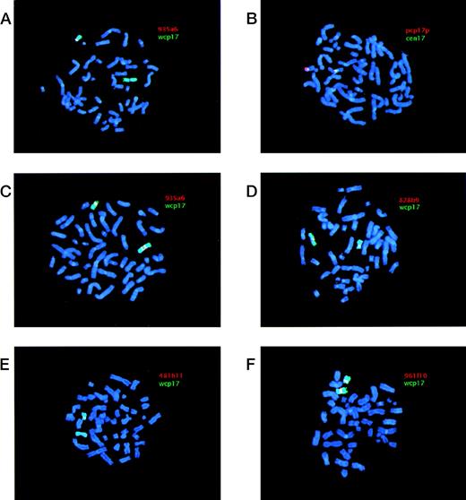 Fig. 2. Examples of FISH analyses of i(17q). YAC and pcp17 probes appear as red signals (Cy3), whereas wcp17 and cen17 probes appear as green signals (FITC). When red (Cy3) and green (FITC) signals are located adjacent to each other a yellow signal is obtained. Chromosomes were counterstained using DAPI, yielding a blue color. (A) Case 1 hybridized with a combination of YAC 935a6 and wcp17 showing the absence of a YAC signal on i(17q) and presence of a signal on the normal chromosome 17. (B) Case 1 hybridized with a combination of pcp17 and cen17 showing two separate centromere 17 signals on the i(17q), with 17p material present in between. (C) Case 7 hybridized with a combination of YAC 935a6 and wcp17 showing a split YAC signal on i(17q), with one signal on each q arm. (D) Case 11 hybridized with a combination of YAC 828b9 and wcp17 showing the presence of a YAC signal on i(17q). (E) Case 11 hybridized with a combination of YAC 481h11 and wcp17 showing the absence of YAC signal on i(17q) and presence of a signal on the normal chromosome 17. (F) Case 19 hybridized with a combination of YAC 961f10 and wcp17 showing the presence of YAC signal on i(17q).