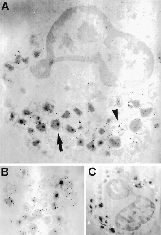 Fig. 3. Transmission electron microscopy of immunogold-labeling of RANTES in unstimulated eosinophils. (A) The arrow indicates gold particles associated with electron-dense crystalloid granules, while the arrowhead shows immunogold labeling of extragranular areas. (B) Higher magnification of another cell. (C) Isotype control using mouse IgG1 antibody. Original magnifications: (A), ×9,100; (B), ×34,000; and (C), ×6,900.