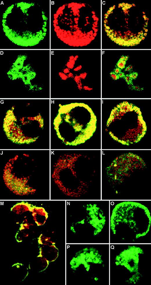 Fig. 4. CLSM of immunofluorescence staining of eosinophils. (A through C) Unstimulated eosinophils labeled with BODIPY FL indicating RANTES immunoreactivity (A), Texas Red corresponding to MBP (B), and combined images (C). (D through F) Higher magnification of eosinophil crystalloid granules showing matrix-associated doughnut-shaped RANTES immunoreactivity (D), surrounding red-labeled cores of MBP immunoreactivity (E), and combined images of the same structure (F). (G through L) Combined images of RANTES and MBP, depicting time course of IFN-γ (500 U/mL) stimulation, comparing (G) unstimulated cells with those stimulated for 5 minutes (H), 10 minutes (I), 30 minutes (J), 60 minutes (K), and 16 hours (L). (M) Lower magnification of combined images of eosinophils stimulated for 10 minutes with IFN-γ. (N) Single-labeled unstimulated eosinophil, compared with (O) cell after 10 minutes stimulation (500 U/mL IFN-γ). (P) Inhibitory effect of 10−6 mol/L genistein added for 10 minutes before IFN-γ stimulation. (Q) Cell incubated with 1,000 U/mL IFN- for 10 minutes. Original magnification × 100 for all images, except for (M), ×63.