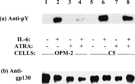 Fig. 2. Western blot analysis for IL-6–induced gp130 phosphorylation in OPM-2 and clone C5 cells before and after ATRA exposure. Cell lysates with equal protein loads from OPM-2 cells (lanes 1 through 4) and clone C5 (lanes 5 through 8) were immunoprecipitated with rabbit anti-human gp130. After SDS-PAGE, immunoblot analysis was done with (a) antiphosphotyrosine (anti-pY) or (b) anti-gp130 antibody and developed by chemiluminescence. Lanes 3, 4, 7, and 8 were from cells pre-treated with ATRA at 10−6 mol/L for 3 days. Lanes 2, 4, 6, and 8 were from cells stimulated with IL-6 at 100 ng/mL for 10 minutes.