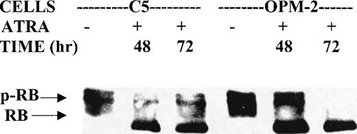 Fig. 3. Effect of ATRA on the phosphorylation of pRB. Whole-cell extracts from control and cells treated with 10−6 mol/L ATRA for 48 and 72 hours were immunoprecipitated with anti-RB antibody. The immunoprecipitates were analyzed by Western blot and probed with a second anti-RB antibody. The phosphorylated (p-RB) and dephosphorylated retinoblastoma protein (RB) bands were as indicated.