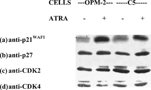 Fig. 4. Effect of ATRA on the expression of p21WAF1, p27KIP1, CDK2, and CDK4 in OPM-2 and C5 cells. Nuclear extracts from control cells and cells treated with 10−6mol/L ATRA for 24 hours were analyzed by Western blot. The blots were sequentially stripped and probed with antibodies to p21, p27, CDK2, and CDK4.