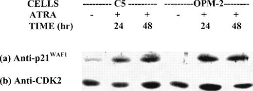 Fig. 5. Kinetic studies of ATRA effect on p21 expression in OPM-2 and C5 cells. Nuclear extracts from control cells and cells treated with 10−6 mol/L ATRA for 24 and 48 hours were analyzed by Western blot. The blots were sequentially stripped and probed with antibodies to p21 and CDK2.