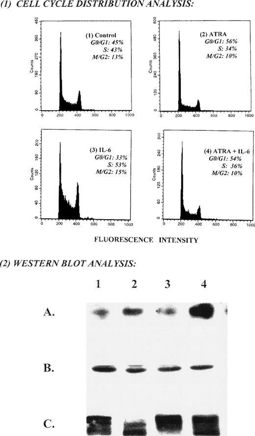 Fig. 6. ATRA-induced G1 arrest and upregulation of p21WAFI and dephosphorylation of pRB is not reversed by exogenous IL-6. Untreated C5 cells (1) and C5 cells treated with 10−6 mol/L ATRA (2), 100 ng/mL IL-6 (3), or both (4) for 48 hours were analyzed by DNA flow cytometry for cell-cycle distribution. Their cellular extracts and immunoprecipitated pRB were analyzed by Western blot (row A, anti-p21; row B, anti-CDK2; row C, anti-RB).