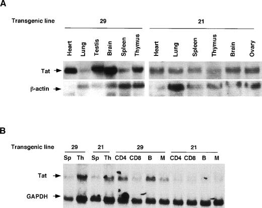 Fig. 2. Expression of HIV Tat mRNA and protein in tissues of transgenic mice. (A) Northern blot analysis Tat mRNA in two independent transgenic lines, 21 and 29. Whole-cell RNA was extracted from spleen, thymus, and other tissues. The RNA samples (20 μg per lane) were size-separated, blotted onto a membrane, and incubated with radiolabeled Tat cDNA probe and, subsequently, with a β-actin cDNA probe. The blot was washed and exposed to x-ray film. (B) Expression of Tat mRNA in lymphoid cells. Lymphocytes were sorted into T-cell and B-cell components, from which total RNA was prepared, size separated, and blotted. A mouse GAPDH cDNA probe was used as an internal control. Sp, spleen; Th, thymus; CD4, CD4-positive T cell; CD8, CD8-positive T cell; B, B cell; M, monocyte. (C) Immunodetection of Tat in histologic sections of transgenic spleens. Spleens of Tat transgenic animals and littermate controls were processed for histology, sectioned, and the sections incubated with an anti-Tat monoclonal antibody. The specificity of this antibody for Tat was documented previously.33 The secondary antibody was a horseradish peroxidase-streptavidin conjugate (×25).
