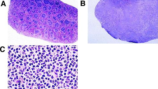 Fig. 3. Histological analysis of spleens of Tat-transgenic and control mice. Tat-transgenic mice (lines 21 and 29) and littermate control mice were killed at 12 to 15 months of age. Spleens were removed and processed for histology. Shown are the representative hematoxylin/eosin stains of (A) a control spleen (10×), (B) a Tat-transgenic spleen (10×), (C) a Tat-transgenic spleen at high magnification (25×).