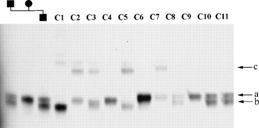 Fig. 2. mllGAAn microsatellite alleles in normal controls. Part of MLL intron 6 was amplified from normal DNA samples and separated on a denaturing PAGE gel (see Materials and Methods). Samples 1 through 3: Mother, father, and son, respectively, from a normal family showing inheritance of alleles. Samples 4 through 14: normal control samples. (a, b, and c) Designation of mllGAAn alleles. Faint bands above the main bands in lanes C1 through C7 are nondenatured PCR products.
