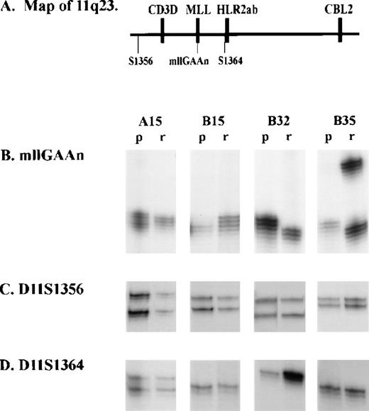 Fig. 3. Analysis of microsatellite polymorphic markers at 11q23 in children with acute leukemias. Microsatellite markers were amplified and separated on a denaturing polyacrylamide gel electrophoresis (see Materials and Methods). p, presentation sample; r, remission sample. (A) Diagram showing location of MLL gene, microsatellite markers (mllGAAn, D11S1356, and D11S1364) and nearby genes (CD3D and CBL2) at 11q23. (B) mllGAAn marker. (C) D11S1356 marker. (D) D11S1364 marker.