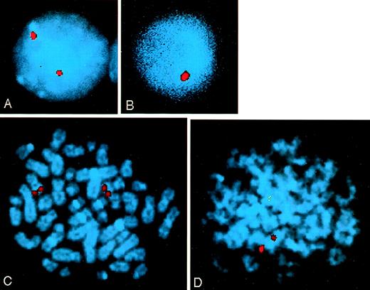 Fig. 4. Analysis of the MLL locus by FISH in patient B22. An MLL locus specific probe was hybridized to cells from bone marrow aspirates taken at presentation. Chromosomes were stained with DAPI. (A) Normal interphase cell with two MLL alleles. (B) Interphase cell with one MLL allele deleted. (C) Normal metaphase cell with two MLL alleles. (D) Metaphase cell with one MLL allele deleted.