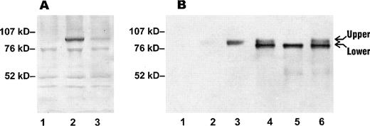 Fig. 5. Immunoblotting of Kell protein in RBCs and transfectants. (A) RBC membrane preparations were separated on a 4-12% gradient SDS-PAGE under reducing conditions and immunoblotted with a polyclonal anti-Kell (see Materials and Methods). Lane 1, Kell null RBCs; lane 2, Kp(b+) (wt) RBCs; lane 3, Kp(a+) RBCs. (B) Protein extracts from 293T transfected cells and RBC membrane preparations were separated on SDS-PAGE under reducing conditions and immunoblotted with the polyclonal anti-Kell. Lane 1, mock-transfected cells; lane 2, Kp(a+) RBCs; lane 3, Kp(b+) (wt) RBCs; lane 4, cells transfected with pRc/CMV-wt Kell; lane 5, cells transfected with pRc/CMV-Kpa; lane 6, cells transfected with pRc/CMV-Kpc. The amount of protein loaded in lanes 1, 2, and 3 in (A) was threefold more than in (B) lanes 2 and 3.