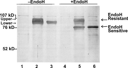 Fig. 6. Endo-H treatment of wild-type Kell and Kpa-transfected cell extracts. Cell extracts from mock-transfected cells (lanes 1 and 4) and cells transfected with pRC/CMV-wt Kell (lanes 2 and 5) or pRC/CMV-Kpa (lanes 3 and 6) were treated with (lanes 4 through 6) or without endo H (lanes 1 through 3), separated on SDS-PAGE and immunoblotted with the polyclonal anti-Kell.
