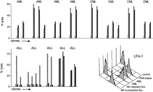 Fig. 3. Leukemia cells are targets for NK cell alloreactivity. NK cell clones which lysed allogeneic PHA lymphoblasts or BLCLs from leukemia patients () were tested for their ability to lyse pretransplant crypreserved leukemic cells from the same individuals (▪), (□ shows autologous targets). CML, AML, and ALL (calla+) cells were used as targets (E:T ratio = 10:1). The alloreactive NK clones killed all the CML and AML targets (top panel). Only a minority of the ALLs were killed (bottom left panel). None of 50 nonalloreactive NK clones killed any allogeneic leukemia (not shown). Bottom right panel: immunofluorescence analysis LFA-1 expression of allogeneic NK cell susceptible and resistant leukemic targets.