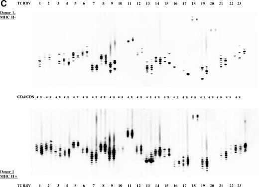 Fig. 2. TCR CDR3 size distribution (spectratype) analysis of overall peripheral TCRBV repertoires in CD4+ and CD8+ T-cell subsets after sorting for MHC class II expression. (A) Results of the TCR CDR3 size distribution analysis in patient 1 before allo-BMT, ie, MHC class II–negative fractions in CD4+ and CD8+ T-cell subsets. (B) Patient 1 one year after allo-BMT, T-cell subsets divided in MHC class II–expressing (MHC II+) or lacking (MHC II−) T-cell fractions. (C) Donor 1. From left to right, TCRBV families 1-23 are depicted in CD4+ and CD8+ T-cell subsets.