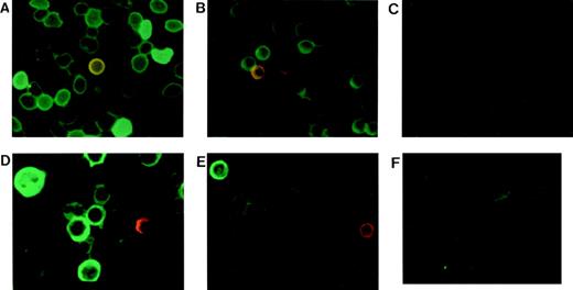 Fig. 1. Embryonic globin protein detection with dual color immunocytofluorescence staining. Samples were from 22-week-old fetus, term cord, and adult blood. Blood smears or cytospins were stained with MoAbs specific for ζ and ɛ globins conjugated with FITC and TR, respectively. (A) Fetal, (B) cord, and (C) adult erythrocytes. (D) Fetal, (E) cord, and (F) adult cultured erythroblasts.