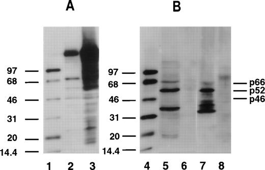 Fig. 1. Tyrosine phosphorylation of Shc proteins in normal CD34+ progenitor cells and leukemic CD34+cells. Total cell lysates (20 μg protein) were subjected to Western blot analysis. Phosphotyrosine was identified by antiphosphotyrosine antibody (4G10). Representative blots are shown. The positions of p66Shc, p52Shc, and p46Shc are indicated on the right. Molecular-weight marker bands are indicated on the left. Lanes 1 and 4, enhanced chemiluminescence protein molecular-weight markers; lane 2, Nonstimulated A431 cell lysate; lane 3, epidermal growth factor–stimulated A431 cell lysate; lane 5, CD34+ cells from normal BM; lane 6, CD34− cells from normal BM; lane 7, CD34+cells from AML patient BM; lane 8, CD34− cells from AML patient BM.