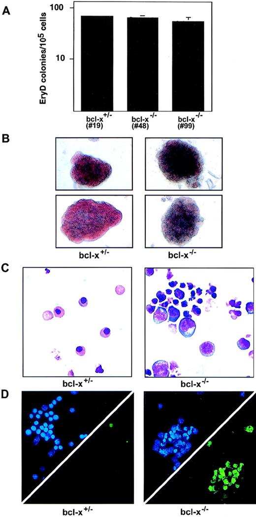 Fig. 4. Bcl-x−/− definitive erythroid cells hemoglobinize poorly and undergo excessive apoptosis. (A) bcl-x+/− and bcl-x−/− definitive erythroid (EryD) precursors were enumerated after replating 10-day-old embryoid bodies into cultures containing Epo and Kit ligand (KL, stem cell factor). Similar results were obtained using two independently derived bcl-x−/− ES cell clones (nos. 48 and 99). Analyses in B through D were performed using bcl-x−/−EryD colonies from clone no. 48. Error bars represent standard error of the mean from three separate cultures. (B) bcl-x−/−EryD colonies are normal in size, but exhibit defective hemoglobinization. Colonies shown are 6 days old. Original magnification × 200. (C) May-Grünwald-Giemsa staining of erythroid cells from 6-day-old bcl-x+/− and bcl-x−/− EryD colonies. Note the larger blast-like cells and cells with pyknotic nuclei within bcl-x−/−colonies. Original magnification × 600. (D) Excessive apoptosis within cells derived from bcl-x−/− EryD colonies. Upper triangles show DAPI staining (blue), which displays the nuclei of all cells. The same cells were stained for apoptosis using the TUNEL stain (lower triangles, green).