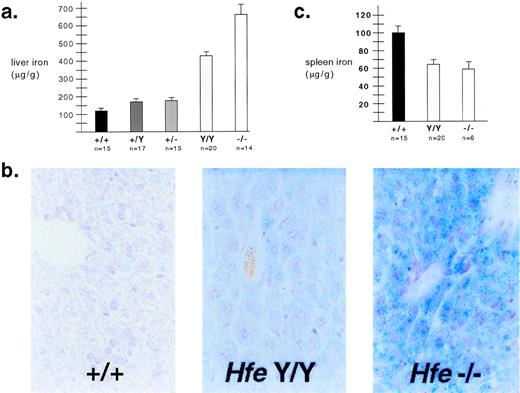 Fig. 2. Iron metabolism in Hfe mutant mice. (a) Liver iron content was determined for 4-week-old 129/SvEvTac mice as previously described10 and expressed as micrograms per gram wet weight ± standard error. Genotypes are abbreviated as follows: wild-type (+/+), Hfe C282Y homozygous (Y/Y ), andHfe null homozygous (−/−). All differences between genotypes were statistically significant when P values were determined by Welch correction of the unpaired t-test. (b) Hepatic iron was visualized by Prussian blue staining of tissue sections from wild-type and mutant F2 mice with a C57BL/6J × 129/SvEvTac background. Nonheme iron deposits appear blue. (c) Spleen iron was determined for 4-week-old 129/SvEvTac mice using the same method as was used for liver iron, and expressed as microgram per gram wet weight ± standard error. Differences between wild-type mice and each mutant strain were statistically significant according toP values determined by Welch correction of the unpairedt-test. The mutant strains were not significantly different from each other.