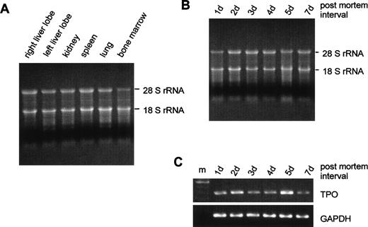 Fig. 2. Influence of the interval between death and tissue sampling on RNA integrity. (A) Fifteen micrograms of RNA from different organs were run on a 1.1% agarose gel containing 2.2% formaldehyde. Tissue samples were obtained 3 days after death. (B) RNA from left liver lobes obtained at different time intervals after death (indicated above gel). (C) GAPDH and TPO RT-PCR signals corresponding to the RNA samples shown in (B); m, 100-bp DNA ladder.