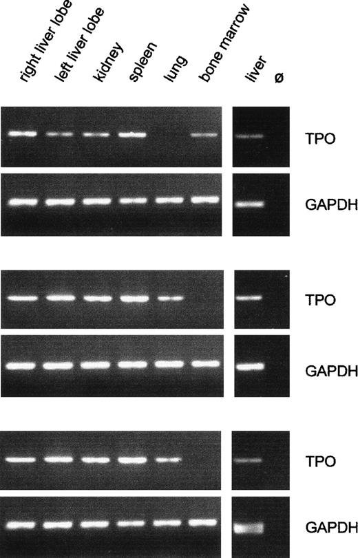 Fig. 3. Qualitative analysis of TPO gene expression in fetal organs. Typical RT-PCR results from three patients are shown. The GAPDH signal did not differ between organs and between individuals, confirming constant efficiency of RNA preparation and cDNA synthesis. The intensity of the TPO signal varied between different organs and between the same organ of different individuals. Only liver and kidney samples were always positive for TPO mRNA. m, 100-bp DNA ladder; Ø, negative RT control, liver RNA plus all reagents except reverse transcriptase.