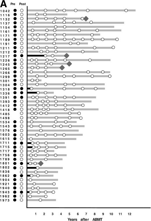 Fig. 4. PCR analysis of BM samples before and after BM purging (left) and after ABMT (right) in 101 informative patients with t(14;18). Patients were grouped according to follow-up BM PCR results. (A) Patients in whom all post-ABMT follow-up BM samples were PCR−. (B) Patients in whom all post-ABMT follow-up BM samples were PCR+. (C) Patients in whom all post-ABMT follow-up BM samples were both PCR+ and PCR−. (•) PCR+ results; (○) PCR−results; (⧫) relapse. Solid lines indicate continuous PCR+ results and shaded lines indicate continuously PCR− results.