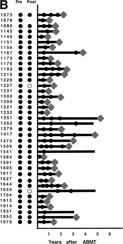 Fig. 4. PCR analysis of BM samples before and after BM purging (left) and after ABMT (right) in 101 informative patients with t(14;18). Patients were grouped according to follow-up BM PCR results. (A) Patients in whom all post-ABMT follow-up BM samples were PCR−. (B) Patients in whom all post-ABMT follow-up BM samples were PCR+. (C) Patients in whom all post-ABMT follow-up BM samples were both PCR+ and PCR−. (•) PCR+ results; (○) PCR−results; (⧫) relapse. Solid lines indicate continuous PCR+ results and shaded lines indicate continuously PCR− results.