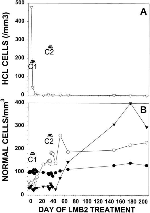 Fig. 2. Response of patient no. 30 to LMB-2. Patient no. 30 received LMB-2 at 63 μg/kg IV QOD × 3 for 2 cycles. Cycle 1 began on day 1 and cycle 2 began on day 32. In (A), the number of HCL cells per microliter (▿) as determined by FACS analysis is shown. Normal blood cells are represented in (B) as absolute granulocyte count in cells per microliter × 10−1 (▾), platelet count per microliter × 10−3 (○), and hemoglobin in grams per deciliter × 10 (•).