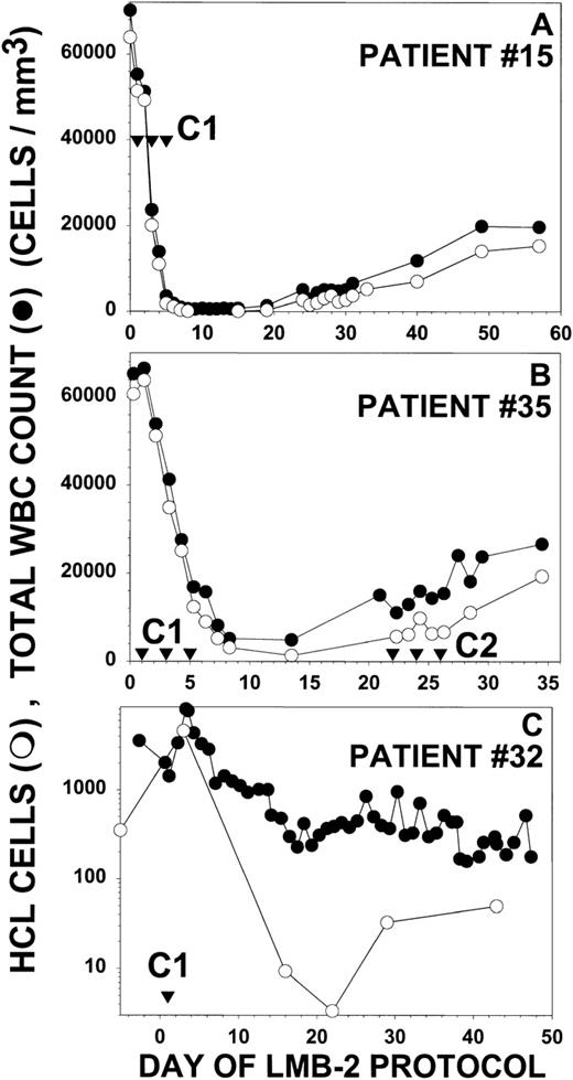 Fig. 5. Response of other HCL patients to LMB-2. For patients no. 15 (A), 35 (B), and 32 (C), the concentrations of circulating WBCs (•) and HCL cells determined by FACS and morphology (○) are shown. Treatment days are shown (▿) for the indicated cycles. Patients no. 15 and 35 in (A) and (B) received LMB-2 at 30 and 40 μg/kg IV QOD × 3, respectively. Patient no. 32 received 1 dose of LMB-2 at 63 μg/kg on day 1. In (C), the Y-axis is depicted showing the log of the WBC and HCL counts to show the wide fluctuation in the counts after the first dose.
