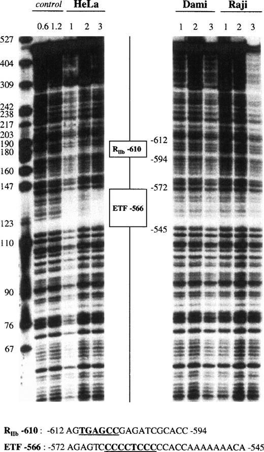 Fig. 5. DNase I footprint analysis of the GPV promoter fragment IV using HeLa, Dami, and Raji cell extracts. The 5′-end-labeled fragment IV (nt −935 to −441) was analyzed as described in the legend to Fig 4, using HeLa, Dami, and Raji nuclear extracts. “RIIb” is a putative repressor binding site with homology to a repressor site in the GPIIb promoter,31whereas “ETF” is a putative binding site for ETF, a member of the Sp1 family.65