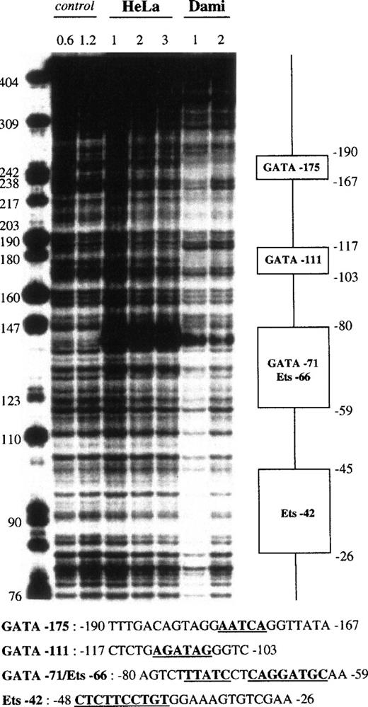 Fig. 7. DNase I footprint analysis of the GPV promoter fragment VII using Dami and HeLa cell extracts. The 5′-end-labeled fragment VII (nt −362 to +28) was analyzed as described in the legend to Fig 4, using HeLa and Dami nuclear extracts.