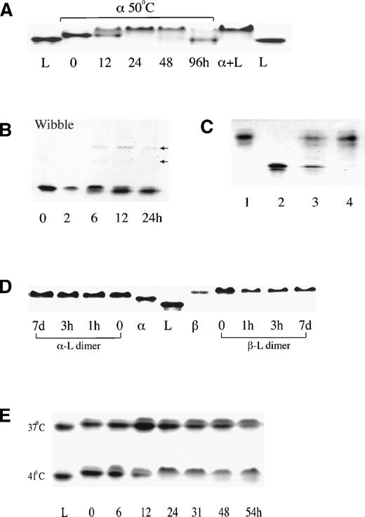 Fig. 1. Nondenaturing PAGE electrophoreses. (A) Normal () antithrombin incubated at 50°C at pH7.4 (buffer A) and in 20% glycerol showing initial appearance at 12 hours of slow dimer band with complete conversion to latent form by 96 hours. A similar result but with more rapid change occurred under the same conditions in the absence of glycerol. L, latent control; + L, 1:1 mixture of and latent antithrombin. (B) A time sequence of incubation of the unstable antithrombin Wibble variant (50°C, pH 7.4, buffer B).10 Careful alignment shows how the transition to the latent form is preceded, in reciprocal proportions, by the formation of the slow dimeric component. Trace polymer bands are also present with the position of the loop-sheet dimer and trimer arrowed. (C) Isoelectric focusing of the stable slow electrophoretic component (lane 3), prepared as in (A), confirms its heterodimeric composition, with separation into equal bands of -antithrombin and latent antithrombin. Lanes 1 and 4, -antithrombin; lane 2, latent standard. (D) Mixing of antithrombins (left) and β (right) 1:1 with latent antithrombin immediately gives the single slow dimeric component that retains its electrophoretic integrity even after 7 days at room temperature. (E) Incubation of normal -antithrombin in buffer B (pH 7.4, 50 mmol/L KCl) showing conversion over 54 hours at 37°C to the slow dimeric form, with acceleration at 41°C to give the appearance of the free latent band at 48 hours.