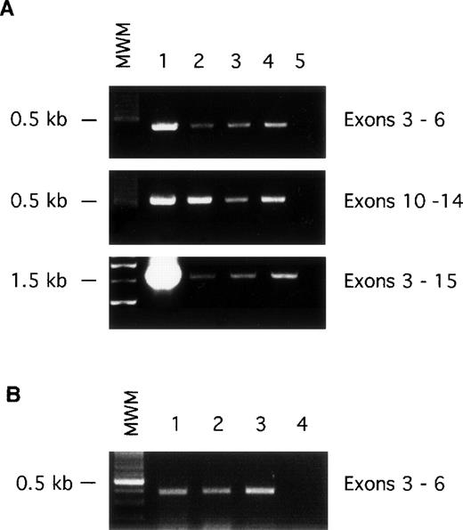 Fig. 2. PCR amplification of FXI mRNA from platelets and megakaryocytic cell lines. PCR was performed as described in the Materials and Methods section. (A) RT RNA extracted from human platelets was used as template to amplify exons 3-6 (top), exons 10-14 (middle), and exons 3-15 (bottom) of the FXI message. Lanes 1, RNA from 293 cells transfected with the human wild-type FXI cDNA (positive control); 2, RNA extracted from fresh platelets; 3 and 4, RNA extracted from platelets obtained by platelet-pheresis; and 5, no template (negative control). (B) RT poly-A RNA from megakaryocytic cell lines was used as template to amplify exons 3-6 of the FXI message. Lanes 1, HEL 92.1.7 cells; 2, MEG-01 cells; 3, CHRF-288-11 cells; and 4, no template (negative control). The positions of molecular weight markers (MWM) in kilobases are shown at the left of the figure.