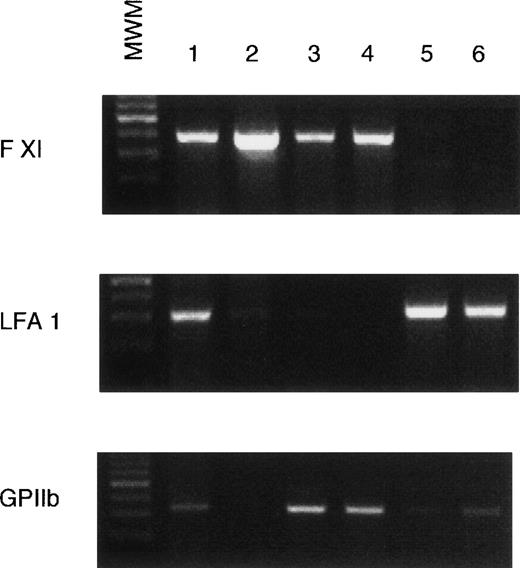 Fig. 3. PCR amplification of FXI exons 3-6, GPIIb, and CD-18 using RT RNA from human platelets, bone marrow, and leukocytes. PCR was performed as described in the Materials and Methods section. Lanes 1, bone marrow; 2, 293 cells transfected with wild-type FXI cDNA; 3, fresh platelets; 4, platelets from platelet-pheresis; 5, granulocytes; 6, mononuclear leukocytes. MWM indicates a 100 bp DNA ladder that serves as molecular weight markers. The intense marker band is 500 bp in size.