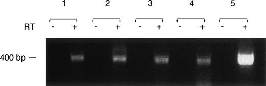 Fig. 4. Control reactions for RT dependence. Reactions for RT of RNA from human platelets or human megakaryocytic cell lines were performed as described in the Materials and Methods section either in the absence (-) or presence (+) of RT. The reaction products were then subject to PCR amplification using the oligonucleotide primer pair specific for exons 3-6 of human factor XI. PCR products were obtained only for reactions in which RT was present. Lanes 1, platelet RNA; 2, HEL 92.1.7 cells; 3, MEG-01 cells; 4, CHRF-288-11 cells; 5, 293 cells transfected with wild-type FXI cDNA. The position of the molecular weight marker is shown at the left of the figure.