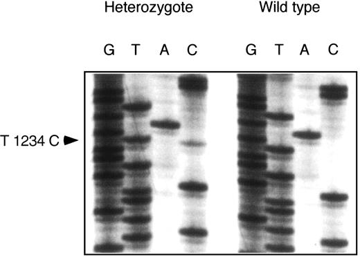 Fig. 5. Nucleotide sequence of an RT-PCR amplified portion of FXI exon 11 from platelet RNA. RT-PCR and DNA sequencing were performed as described in the Materials and Methods section using platelet RNA from an individual known to be heterozygous for a T to C polymorphism within amino acid codon 379 of FXI (nucleotide position 1234 of the human cDNA sequence18) and a person homozygous for the wild-type (T) allele. The arrow indicates the position of the polymorphism. Note the signal for both a T and C residue at this position for the heterozygous individual.