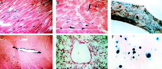 Fig. 5. The mvWF LacZ transgene is expressed in a vascular bed-specific pattern. LacZ staining of 10-μm tissue sections from mvWFlacZ line no. 47 shows reporter gene activity in endothelial cells of the heart (A), skeletal muscle (B), and brain (D). An en face preparation of the thoracic aorta shows diffuseLacZ staining of endothelial cells (C). A bone marrow aspirate shows the X-Gal reaction product in megakaryocytes (F). There is no detectable β-galactosidase activity in other tissues (E shows lung). The blue staining in the lung represents backgound.